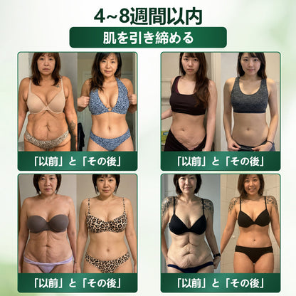 🛒BOMSTF®＆NAD+ 8-in-1 ナノ強化フォーミュラ【アップグレード版】内臓脂肪 / 肥満 / 糖尿病 / 睡眠時無呼吸 / 関節ケア / 肌のたるみ 集中サポート🛒🛒